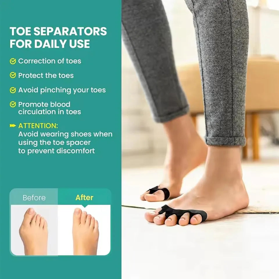 ToeAlign™ – Separators that align the toes and reduce pressure on the feet