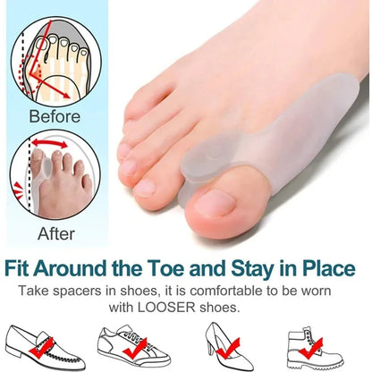BunionRelief™ – A corrector that relieves pain and helps align the big toe
